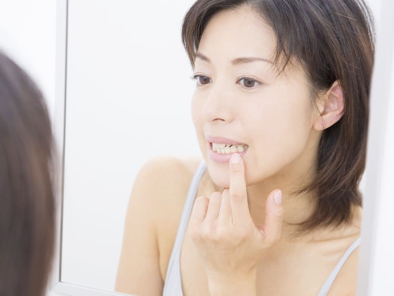 歯周病イメージ